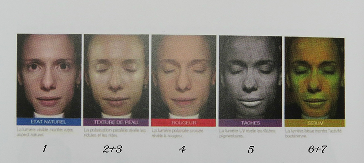 ioma2