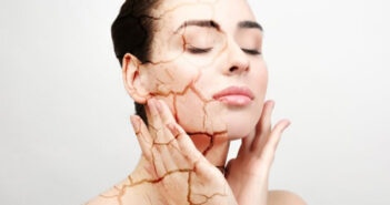 pelle disidratata estate